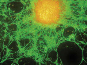 Kankerstamcellen zouden de oorzaak kunnen zijn van resistentie. beeld: ANP Photo