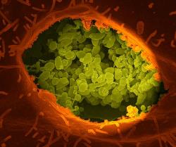 Foto: CDC/ National Institute of Allergies and Infectious Diseases