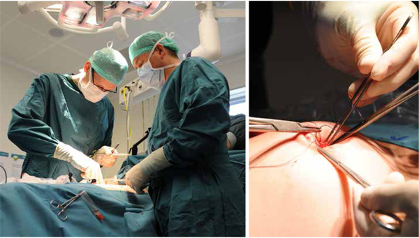 In het Elkerliek ziekenhuis zijn sinds de nieuwe aanpak meer dan 110 patiënten met complexe buikwandbreuken operatief behandeld.