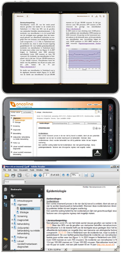 Van boven naar beneden: verschillen tussen weergave van de richtlijn Niercelcarcinoom als e-book (iPad), via een webpagina (smartphone) en als pdf.