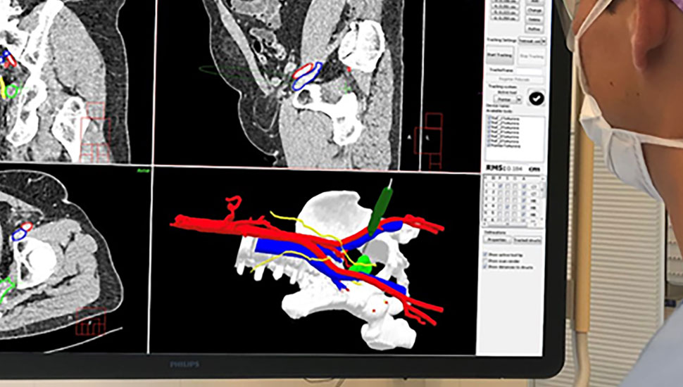 Foto 2: Inspectie van de CT-scan en het gemaakte 3D-model op de hybride ok, met daarin kritieke structuren gesegmenteerd en het getrackte chirurgische instrument.