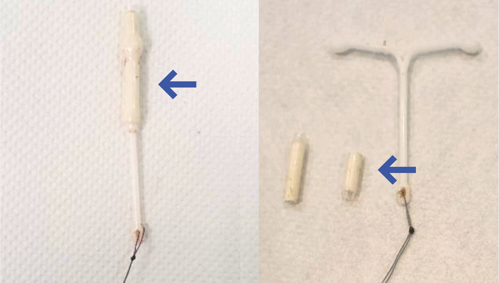 Foto auteur. Links: hormooncilinder. Rechts: verwijderde en doorgeknipte hormooncilinder