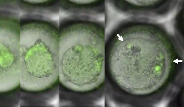 Zijn kunstmatige tweelingembryo’s ‘Holland’s Next Embryo Model’?