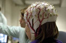 EEG bij epilepsie