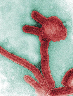 Het marburgvirus behoort evenals het ebolavirus tot de Filoviridae. beeld: PHIL