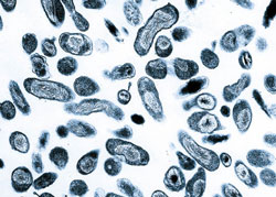 Coxiella burnetii, de bacterie die Q-koorts veroorzaakt. beeld: PHIL