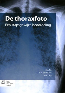 M.J. Tip (e.a.), De thoraxfoto. Een stapsgewijze beoordeling, Bohn Stafleu van Loghum, 187 blz., 44,95 euro. 