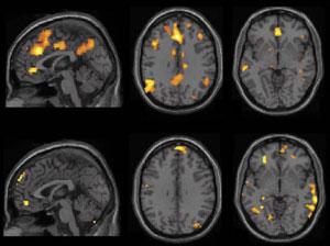 Ook als de hersenen niet actief worden gebruikt, vertonen allerlei hersengebieden activiteit. beeld: Kalina Christoff
