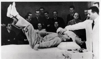 Lucio Bini controleert de gebitsbeschermer tijdens een ongemodificeerd grand-malinsult (maart 1948). beeld: universiteit van Toronto, Canada